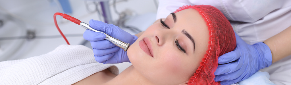 Microdermabrasion